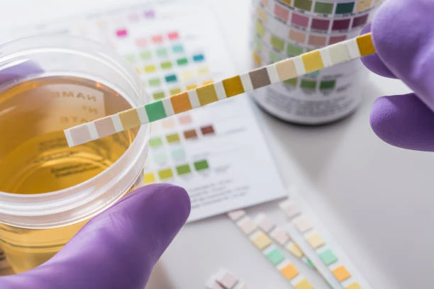 Pcmso exames toxicológicos